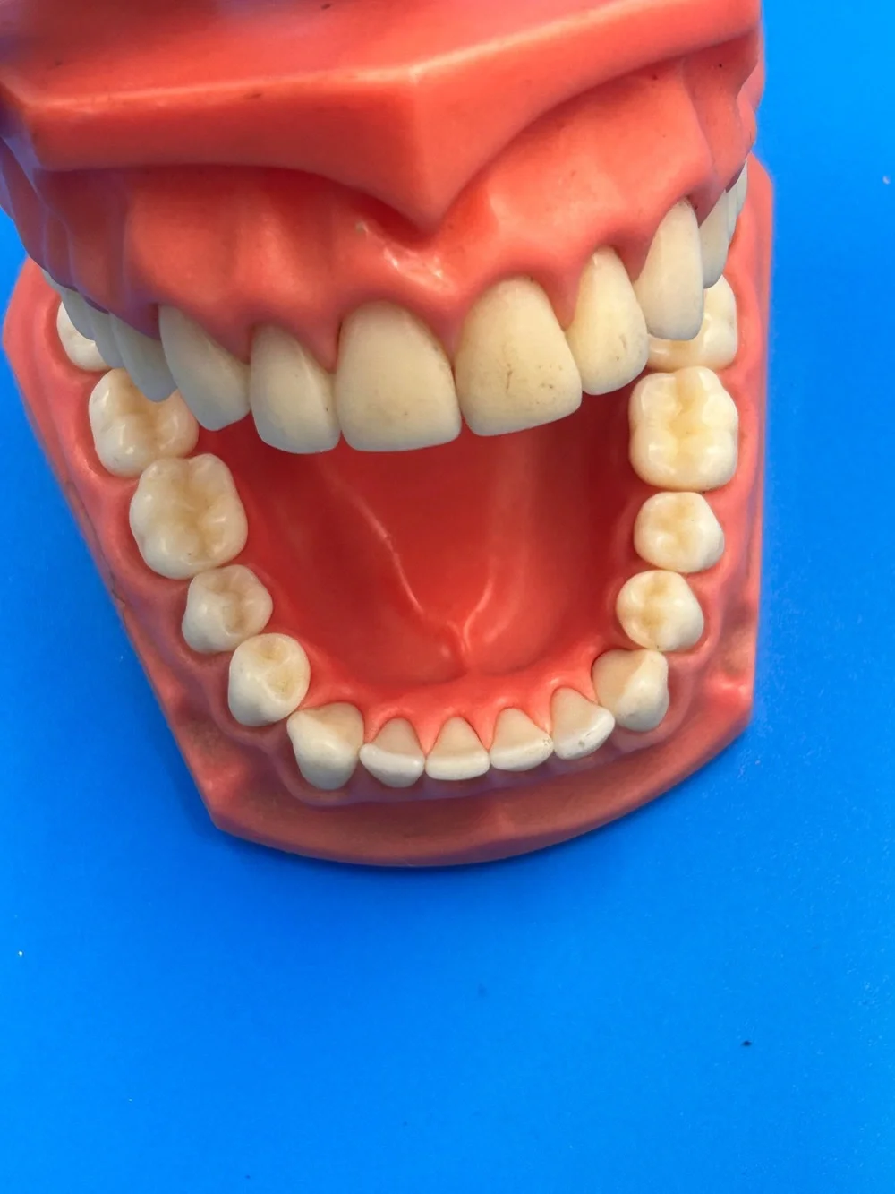 Vintage Dental Teaching Model - Coral Pink Educational Teeth Display